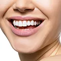 woman showing her teeth to show that moringa maintains strong and healthy teeth