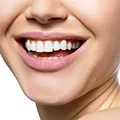 woman showing her teeth to show that moringa maintains strong and healthy teeth woman showing her teeth to show that moringa maintains strong and healthy teeth