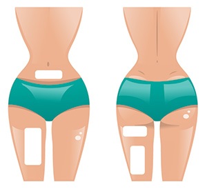 Slimming Patches Illustration Slimming Patches Illustration