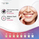 mysmile-teeth-whitening-gel-uk-04
